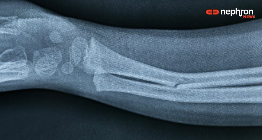 broken arm x ray