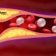 Arteries with clogged fat