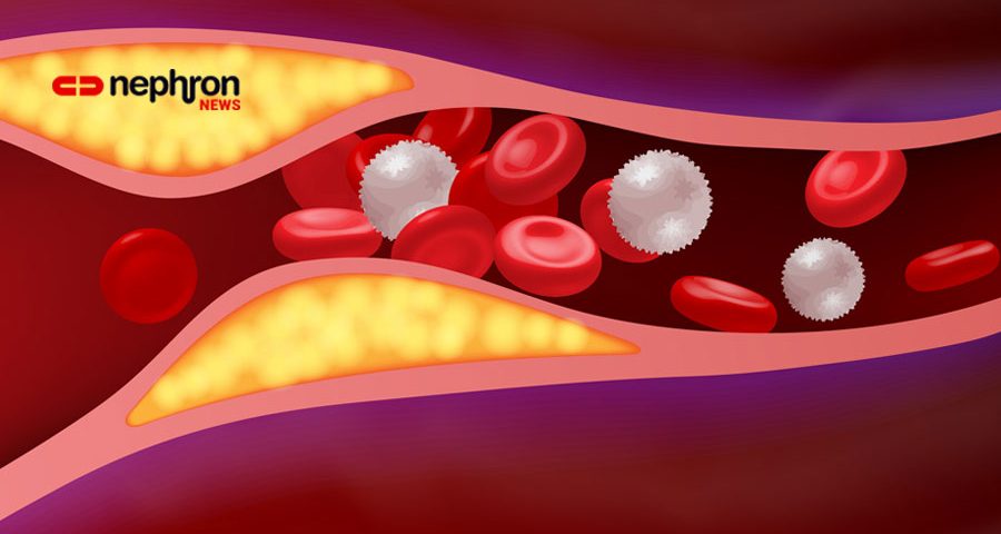 Arteries with clogged fat